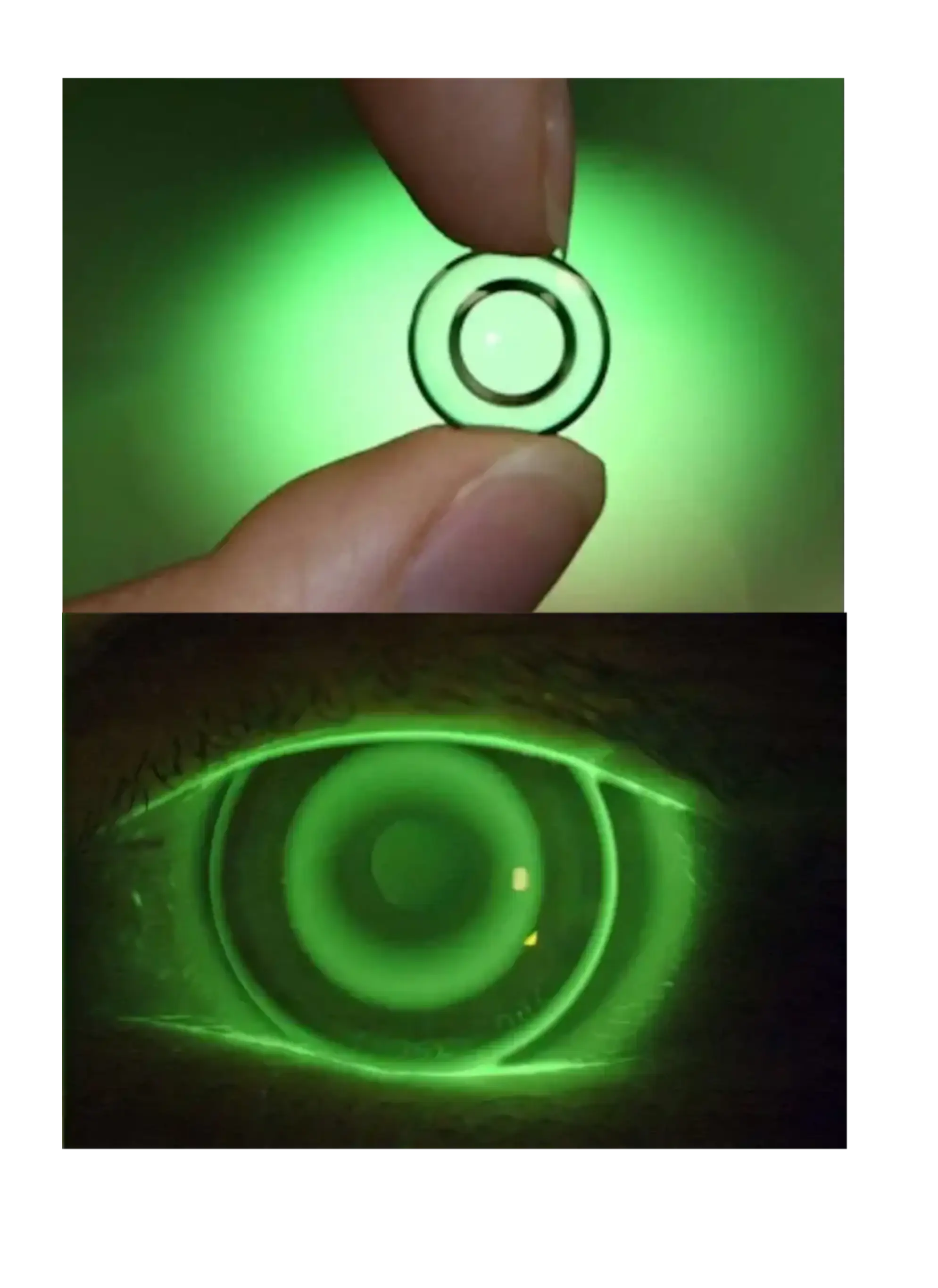 Lens Trial Session